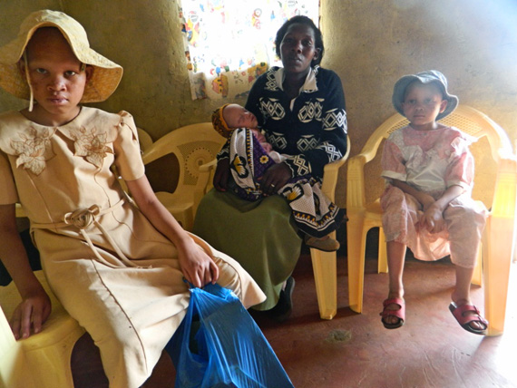 mother-with-three-albino-children