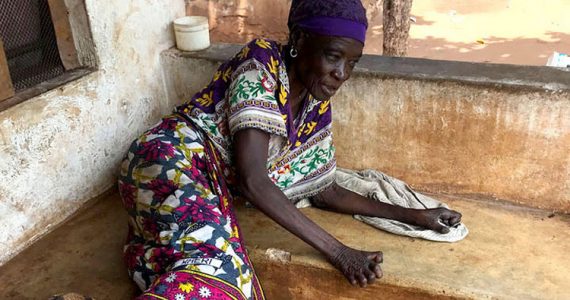 Picture of leprosy-affected victim in Kenya