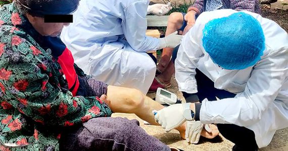 Image of victims of leprosy receiving wound care