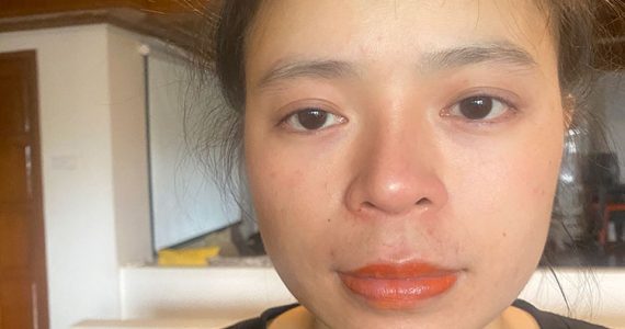 Image of rescued victim of slavery in Vietnam