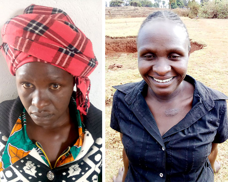 Picture of Carolyne’s before and after surgery