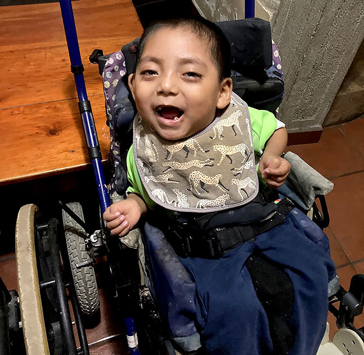Image of boy in Guatemala with medical need smiling
