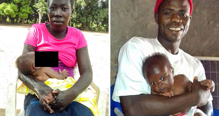 Pictures of children with disabilities in Africa