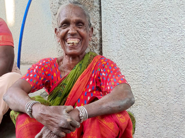Image of victim of leprosy in India