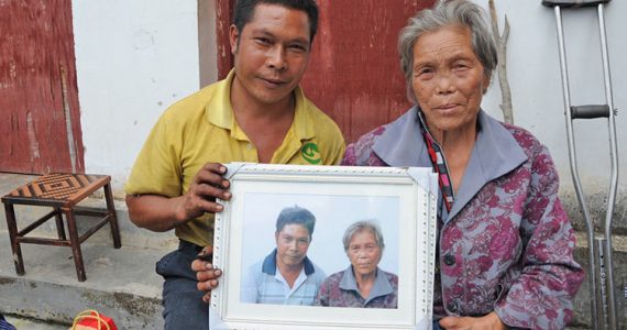 Picture of leprosy-inflicted patient