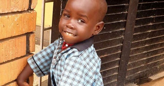 Picture of girl with clubfoot in Uganda
