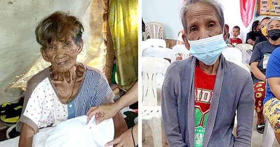 Image of Salvacion before and after healing