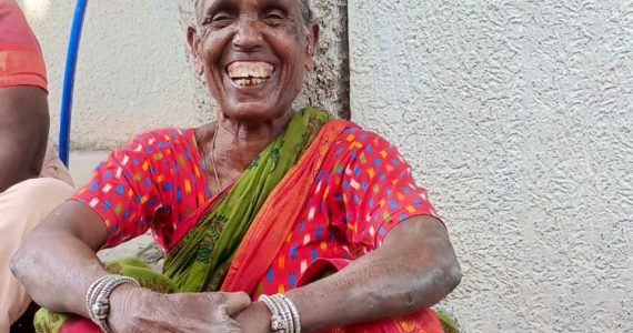 Image of leprosy victim